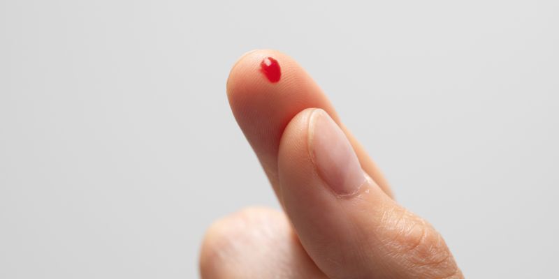Từng ý nghĩa về giấc mơ thấy máu